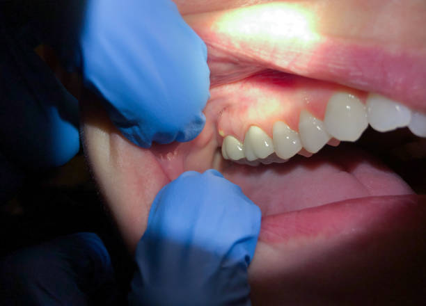 Best Weekend Emergency Dentist in Flora, MS